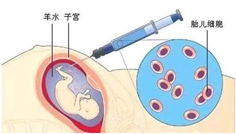 無創(chuàng)胎兒親子鑒定、羊水親子鑒定、毛發(fā)親子鑒定分別怎么做？