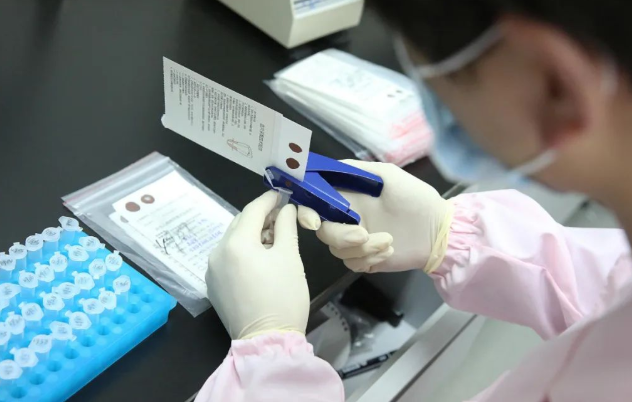 怎么進(jìn)行親子鑒定最方便？